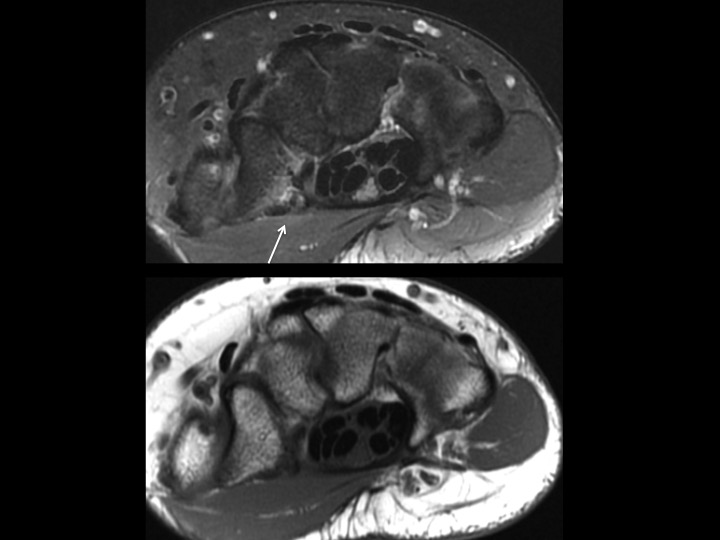 Figure 3 for case trapezium ( RID2193 )